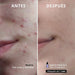 Serum Facial Azelaic Radiance 50ml - Freshly Cosmetics - 1